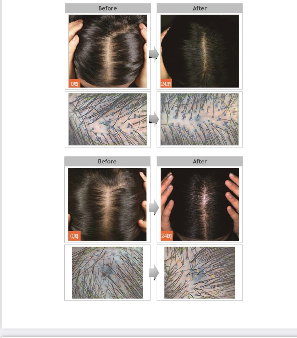 HAIR BOOM AIR ( MADE IN KOREA)