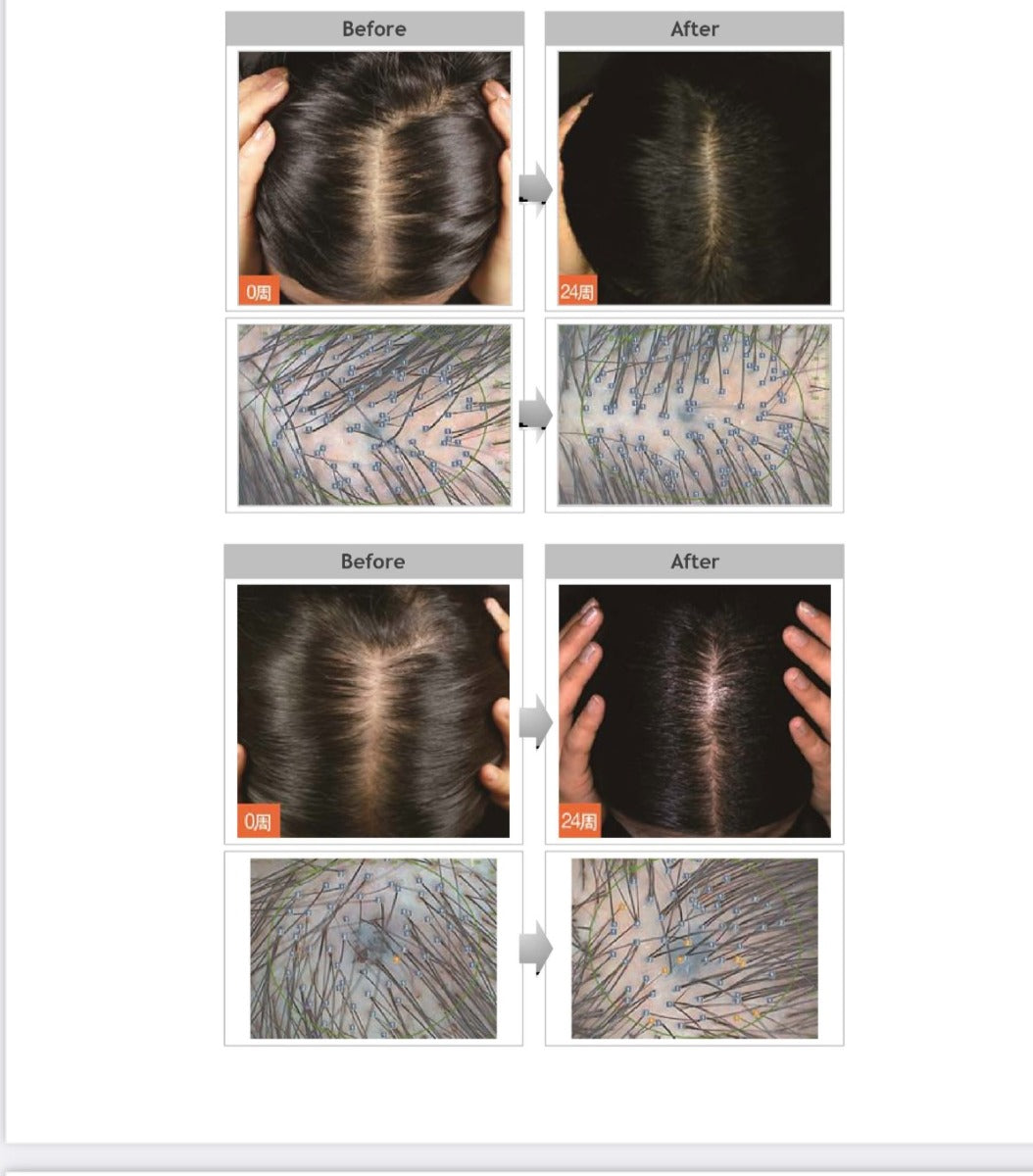 HAIR BOOM AIR ( MADE IN KOREA)